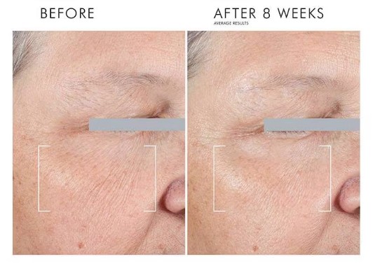Skinceuticals AGE アドバンスド　アイ　2