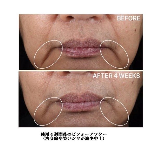 StriVectin Contour Restore Tightening & Sculpting Face Cream 2